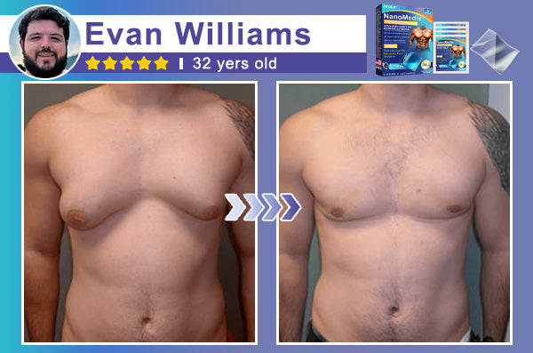 ⚕️GFOUK® NanoMedix Gynecomastia Chest Fatburn & Firm Patch