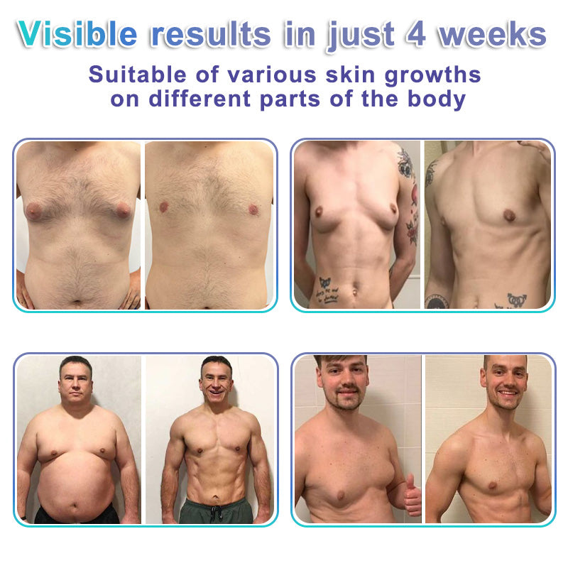 ⚕️GFOUK® NanoMedix Gynecomastia Chest Fatburn & Firm Patch